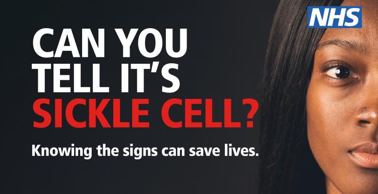 Sickle Cell NHS