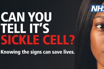 Sickle Cell NHS